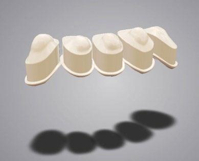abutments, onlays, veneers, and more. It offers an open architecture.