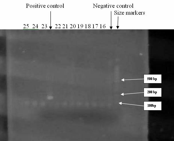 Agarose Gel Electrophoresis: A total of 10 µl of PCR product was added to loading buffer and run on a 2.5% agarose gel (Biometra) at 95 volts for 60 minutes.