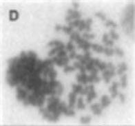 D) Polyploidy E) Dicentric Chromosome F) Sticky plate G)