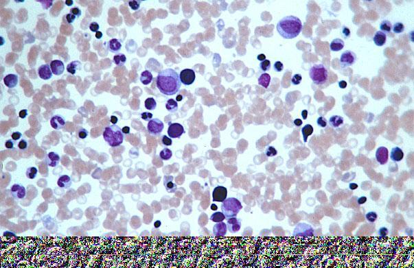 Nucleus of immature hematopoietic cells Nucleus of maturing granulocytes