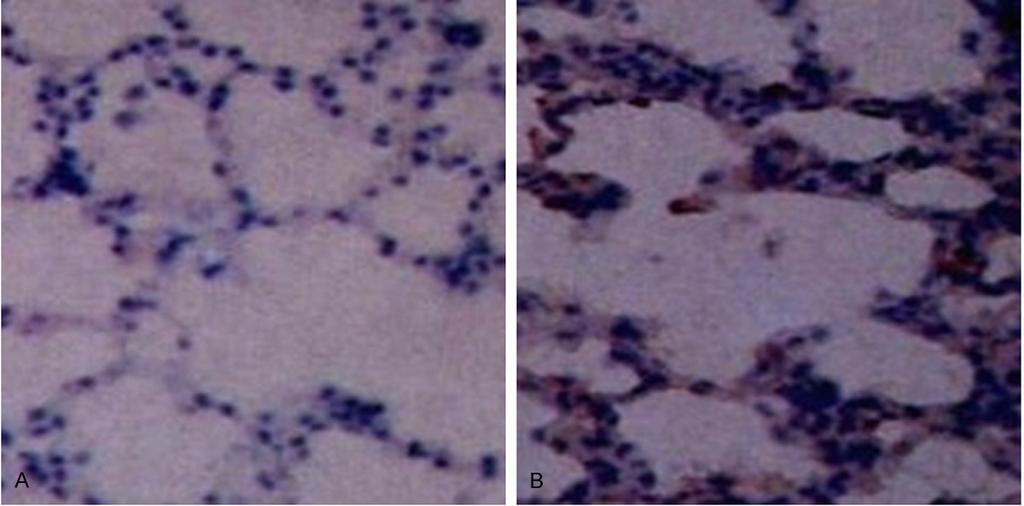 Figure 2. Brdu-labeled mesenchymal stem cells (SP, 400). (A) Control and (B) transplantation groups. no-9-ethylcarbazole.