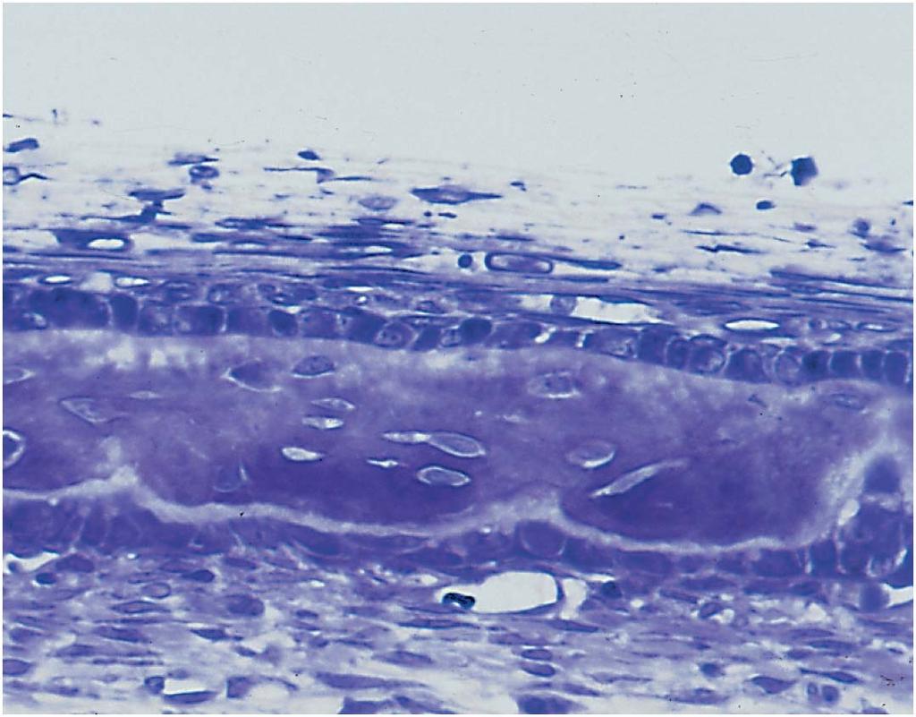 Intramembranous Ossification Periosteum: Fibrous layer Osteogenic layer Osteoid tissue