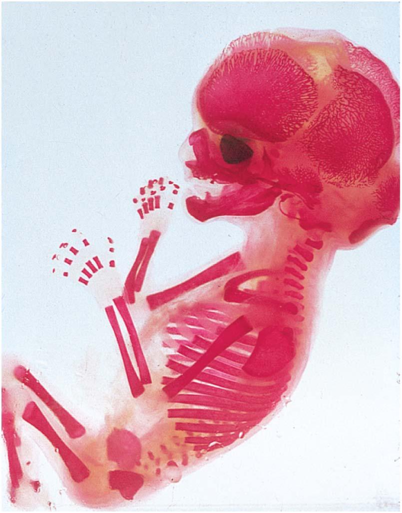 Fetal Skeleton at 12 Weeks Copyright The McGraw-Hill Companies, Inc. Permission required for reproduction or display.