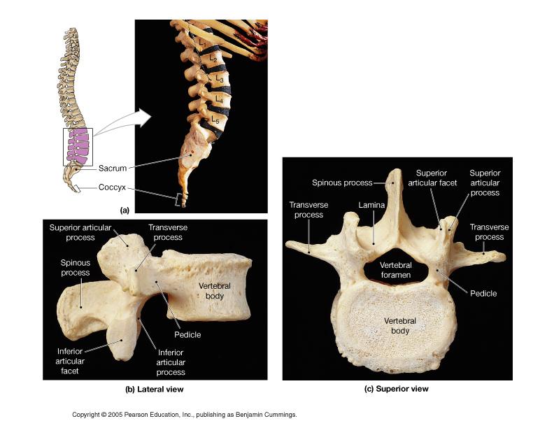 Lumbar vertebrae (5) Sacrum and Coccyx Thoracic