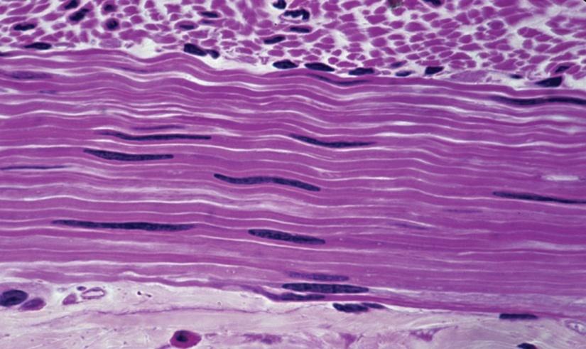2) smooth muscle involuntary (cannot control it) non striated