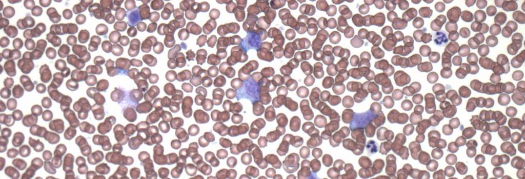 Necropsy: useful for lymphoid