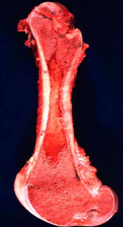 Myeloid system: Bone