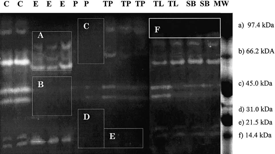 ( ) A.S.C. Chong et al.raquaculture 203 2002 321 333 327 proteases, in particular trypsin and chymotrypsin, together with metalloproteases as the major groups of proteases in the discus intestine.