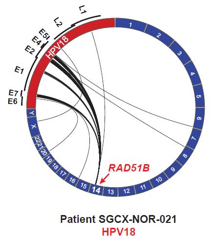 Supplementary Figure 19. Recurrent HPV integration into the RAD51B locus The Circos plots depict RAD51B integration events present in 3 of the 79 tumors with transcriptome sequencing data.