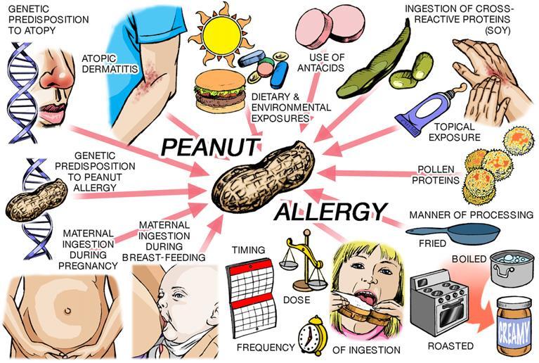 Food allergy Can we prevent food allergies?