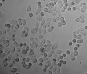 There was approximately 63% decrease in HeLa cells viability treated by 28 µg/ml EFC combined 8 µm cisp for 24 h.