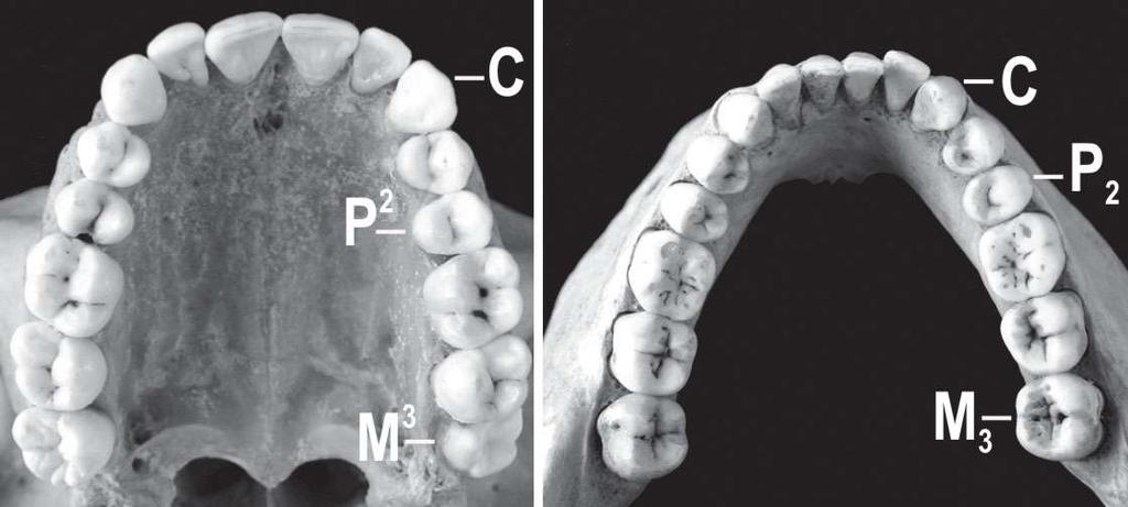 Human adult dentition. Tooth formula is similar in both jaws: two incisors, one canine, two premolars and three molars.