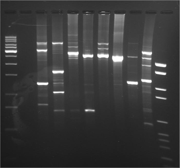 10 11 12 13 14 15 16 17 18 : RAPD-PCR :- : Kb : bp : :- ( ) H. pylori.