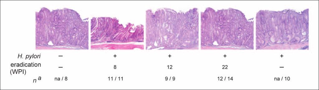 Cancer Research Figure 1. Histopathology of gastric disease induced by H. pylori infection in the corpus mucosa of INS-GAS mice with and without eradication therapy.