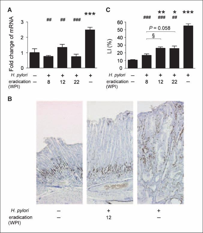 Cancer Research Figure 5. Relative mrna levels of Reg 1 in gastric tissue (A), immunohistochemical staining of Ki67 (B), and LIs of Ki67 (C) in the corpus.
