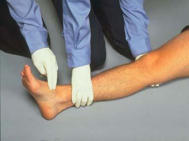 initial injury (splint loose or excessive motion)
