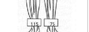 Ankle-Brachial Index Segmental recordings 20 mm Hg