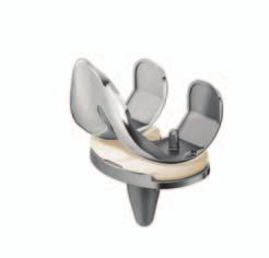 KNEE SOLUTIONS DePuy Synthes s philosophy in knee replacement