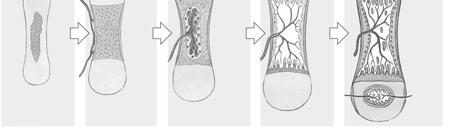 Articular cartilage Enlarging chondrocytes within calcifying matrix Epiphysis Diaphysis Marrow Marrow Epiphyseal cartilage formation Primary ossification center Blood vessel Blood vessel Secondary