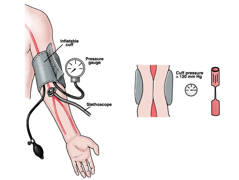 PowerPoint Lectures for Biology: Concepts & Connections When the cuff is inflated so that it stops arterial blood flow, no sound can be