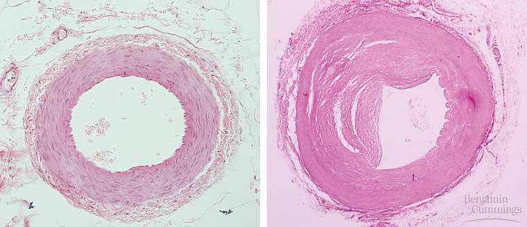 elastic Walls are composed of three layers Epithelium Basement membrane Epithelium Epithelium Smooth muscle Smooth CAPILLARY muscle Connective