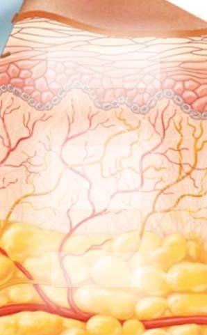 increased permeability of blood vessels Nerve Subcutaneous tissue Prostaglandins Leukotrienes Intensity histamine and kinin effect Increased permeability of blood