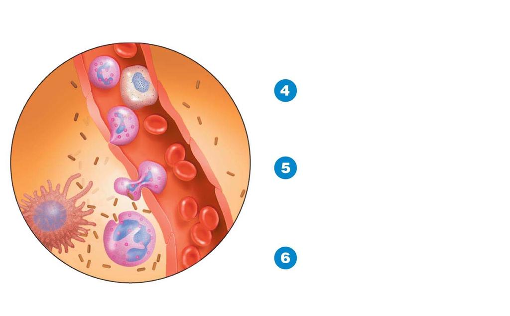 Figure 16.9b The process of inflammation. Blood vessel endothelium Monocyte Bacterium RBC Margination phagocytes stick to endothelium.
