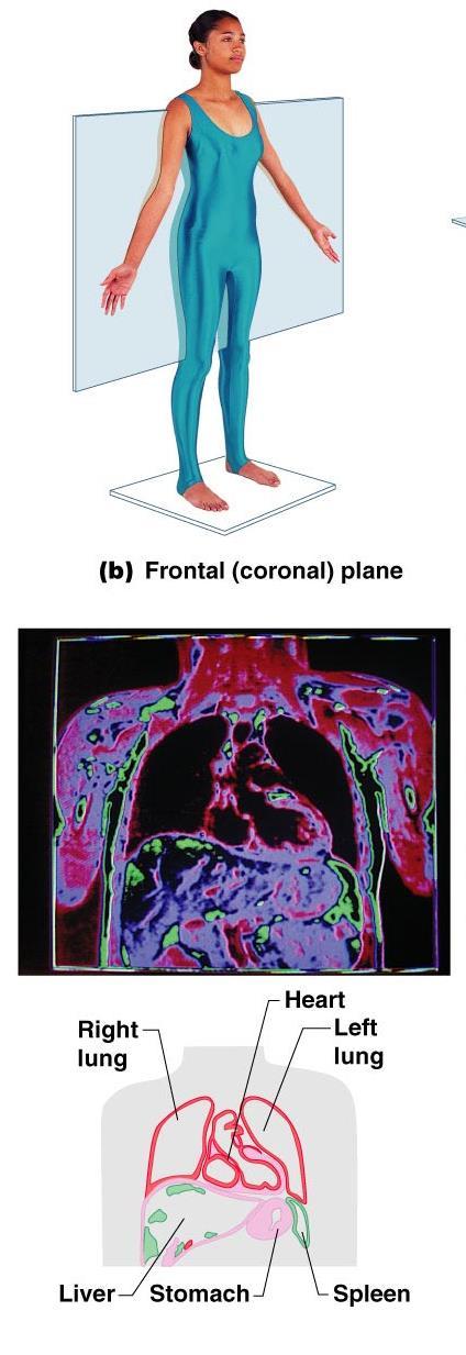 Body Planes and Sections A frontal section divides the body (or