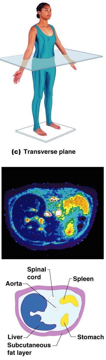 Body Planes and Sections A transverse, or horizontal, section divides the body (or organ) into superior and inferior