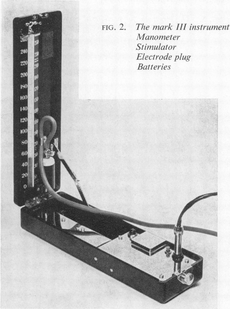 Gut, 1969, 10, 155-159 Present position of the electrical stimulation test H. BURGE, T. B. L. ROBERTS, R. D. STEDEFORD, AND M. J.