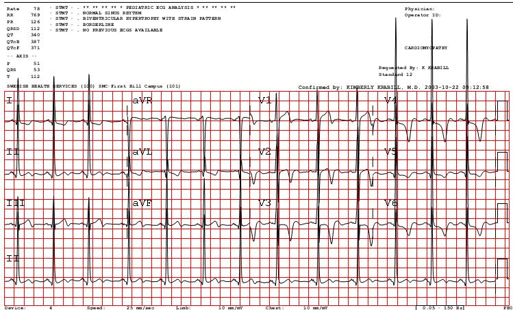 Case one 14 year old female teen presents with a murmur and history of tachypnea and left midsternal chest pressure with exercise. The pain radiates to her left shoulder.