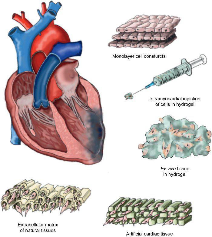 Cardiac tissue engineering: novel approaches of cell delivery