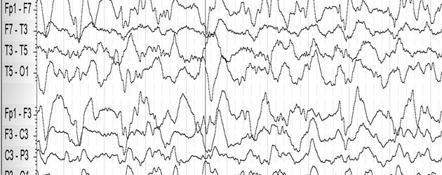 EEG EEG EEG EEG An