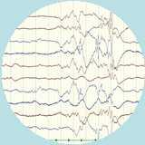 EEG in the premature