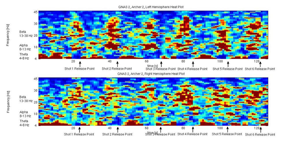 Combined EEG and Eye-tracking in sports training & analysis 7 Results Scores 9 9 9 9 8 7 EEG heat plot results for left and right side of brain.