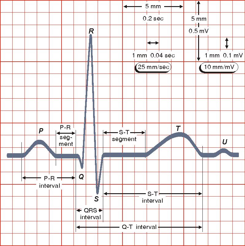 Electrocardiography (ECG) Measures galvanically the electric activity of the heart Well known and traditional, first measurements by Augustus Waller using capillary