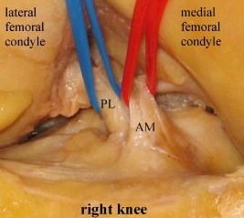 ANTERIOR CRUCIATE LIGAMENT Femoral side: arises from posteromedial corner of medial aspect