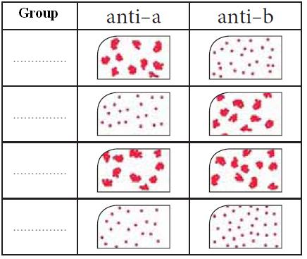 8- Answer the following question 1- Complete the previous table mentioning blood groups 2- Which blood group has both types of antigens? 3- Which blood group has both types of antibodies?
