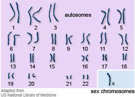 Turner's syndrome Causes of Turner's syndrome When an abnormal ovum (O+22) Ovum without X chromosome is fertilized by a sperm (X+22), forming a fetus (XO+44) fetus with only one X chromosome (instead