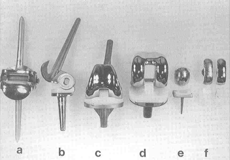 Knee Systems Various types of knee joints: (a) metal hinged, (b) hinged with plastic liner, (c) intermedullary