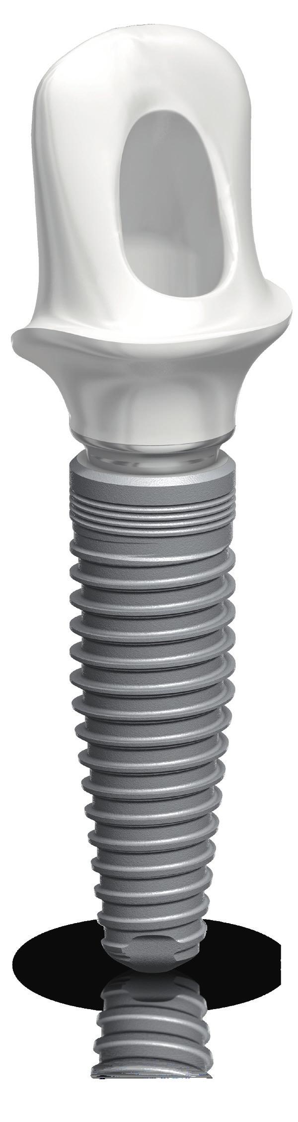 NobelReplace Conical Connection Product overview High primary stability, even in compromised