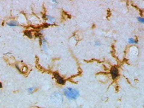 Microglial cells in the brain, stained by virtue of