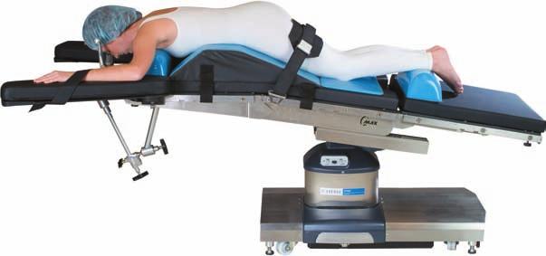 (BF01) Multi-Poise Headrest (BF038) Foot Extension with Siderail Locks (BF2) Prone (or supine) Neurosurgery Prone (or supine) position for craniotomy using the Multi-Poise Headrest.