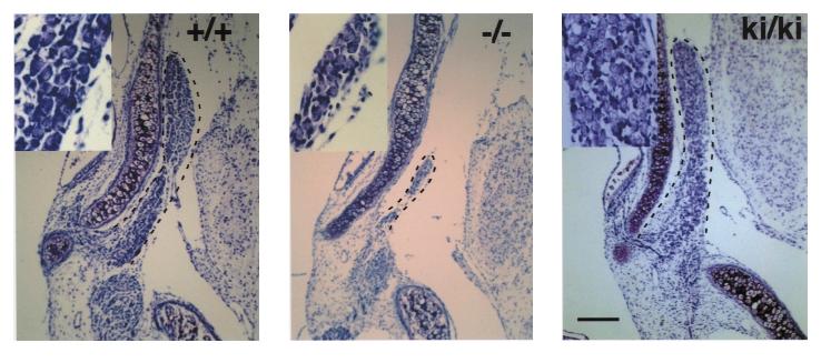 articles Fig. 2. Rescue of vestibular neurons in Bdnfnt 4-ki/nt4-ki newborn mice.