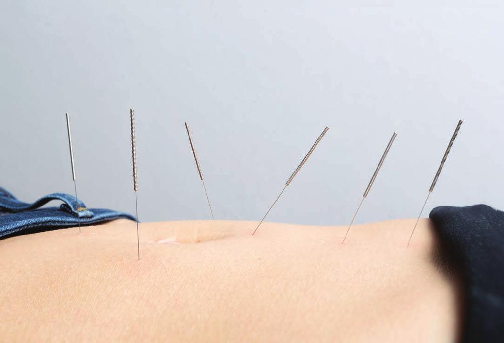 9 2. Chinese Acupuncture to align the qi Chinese medicine works to align the qi which is the body s natural energy flow, when a disease or illness is present the energy flow is disrupted.