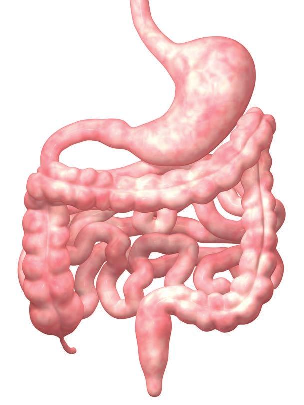 4 Causes:???? IBS can be caused by a variety of interrelated diet and lifestyle factors.