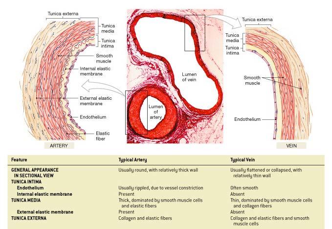 Artery vs.