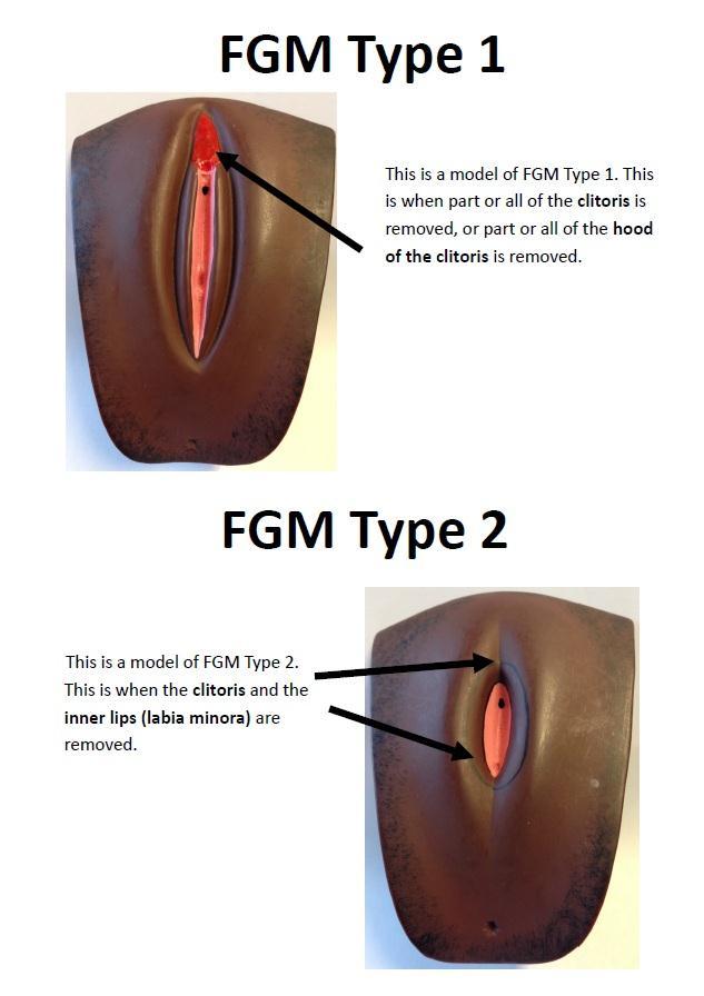 Female Genital Mutilatin (FGM) Schls