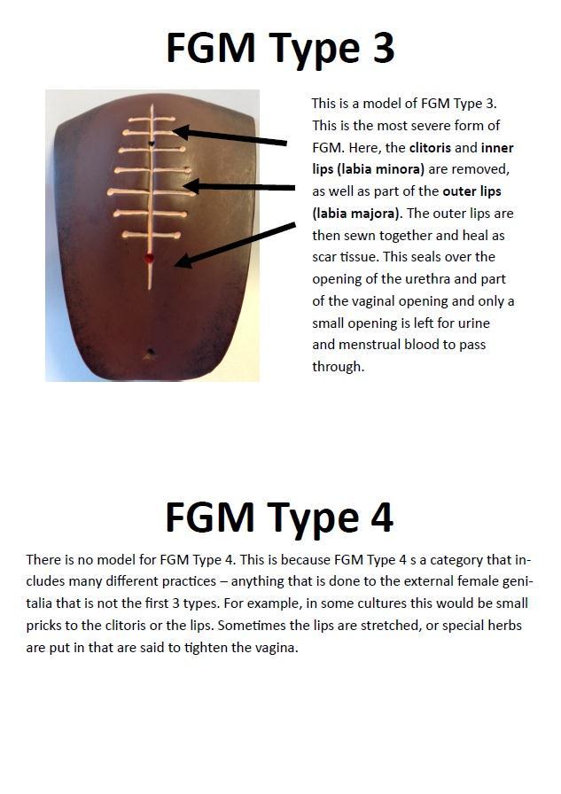 Female Genital Mutilatin