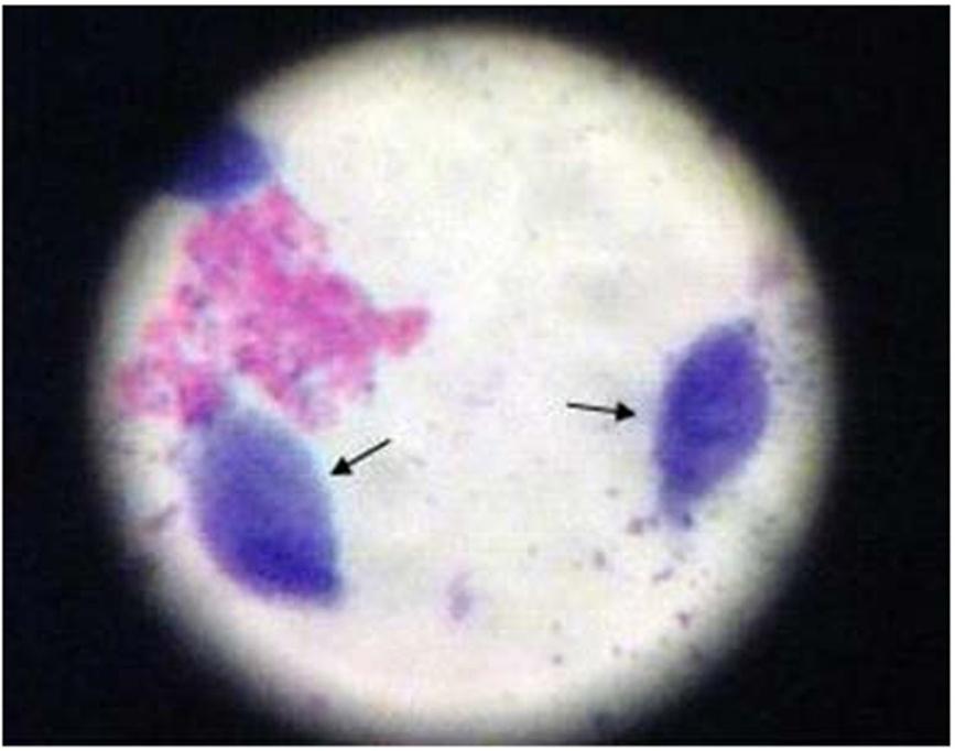 The whole smear was examined using conventional light microscopy for motile Trichomonas vaginalis with low power objective ( 10), then with high power objective ( 40).